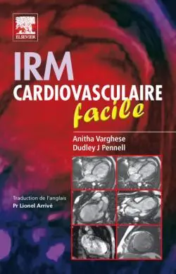 IRM cardiovasculaire facile