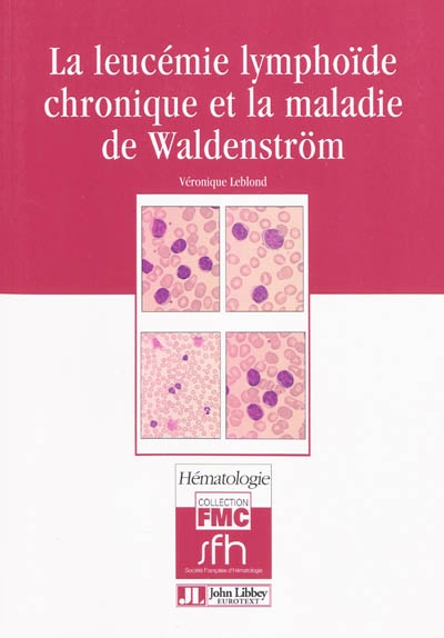 La leucémie lymphoïde chronique et la maladie de Waldenström
