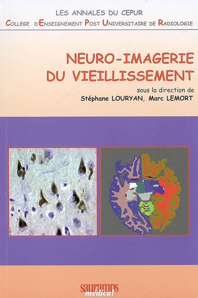 Neuro-imagerie du vieillissement