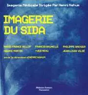 Imagerie du sida