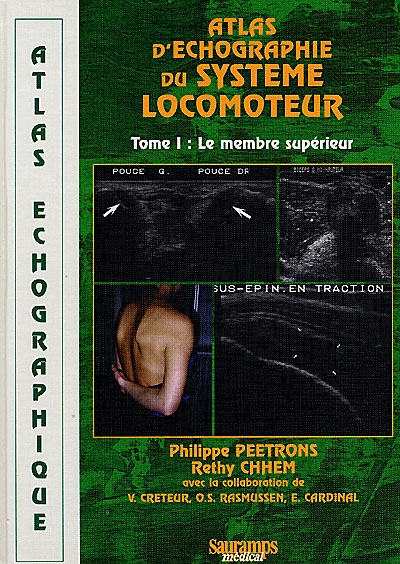 Atlas d'échographie du système locomoteur. Vol. 1. Membre supérieur