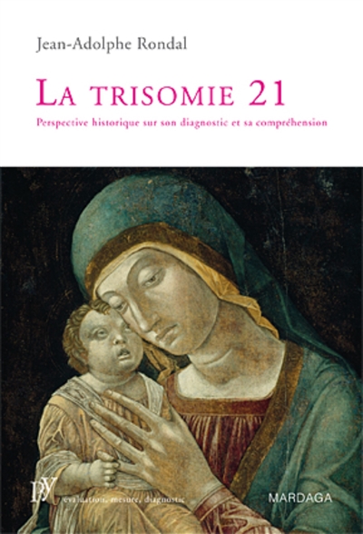 La trisomie 21 :...