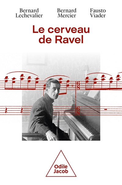 Le cerveau de Ravel