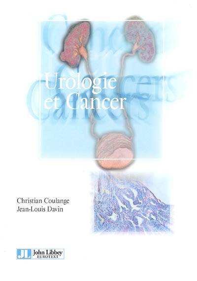 Urologie et cancer