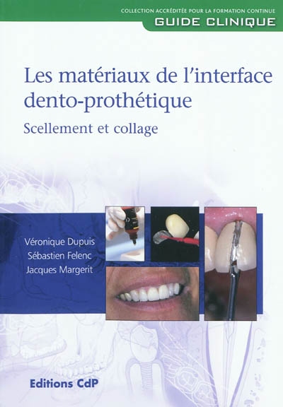 Les matériaux de l'interface dento-prothétique : scellement et collage