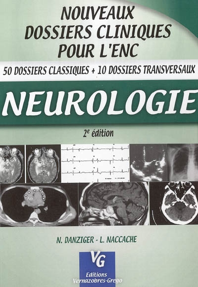 Neurologie : 50 dossiers classiques + 10 dossiers transversaux