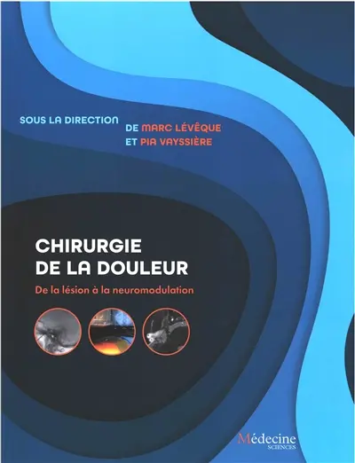 Chirurgie de la douleur : de la lésion à la neuromodulation