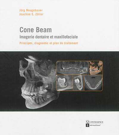 Cone Beam : imagerie dentaire et maxillofaciale : principes, diagnostic et plan de traitement
