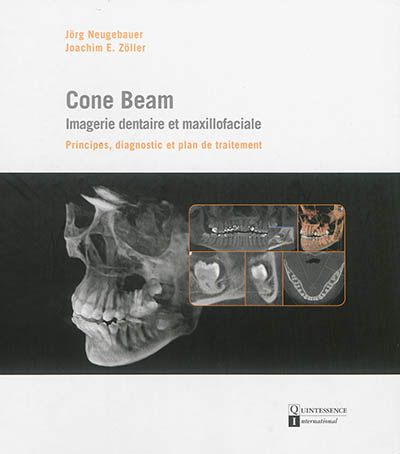 Cone Beam : imagerie...