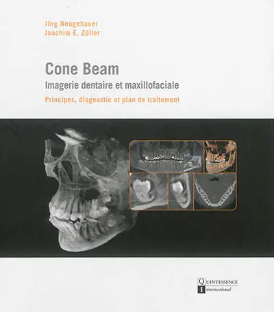 Cone Beam : imagerie dentaire et maxillofaciale : principes, diagnostic et plan de traitement