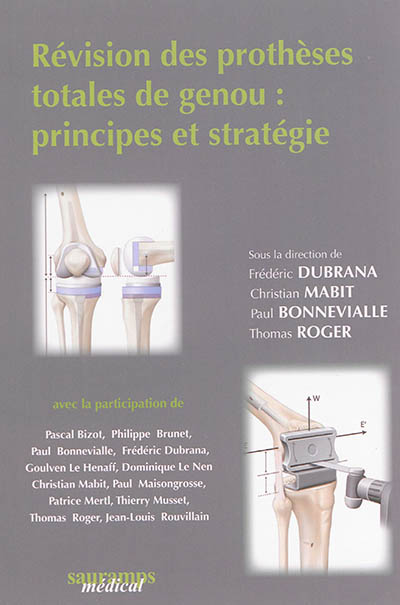 Révision des prothèses totales du genou : principes et stratégie