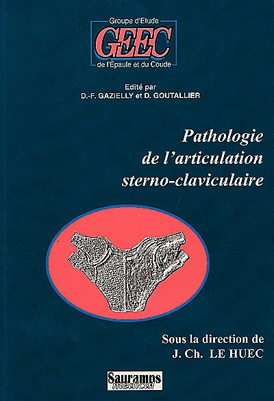 Pathologie de l'articulation sterno-claviculaire