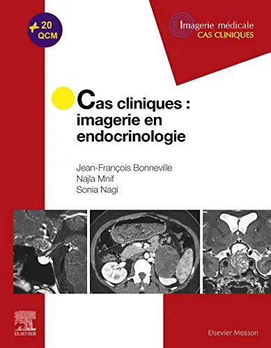 Cas cliniques : imagerie en endocrinologie