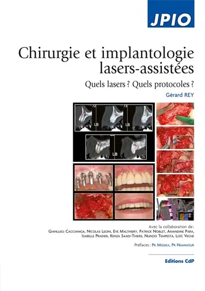 Chirurgie et implantologie lasers-assistées : quels lasers ? Quels protocoles ?