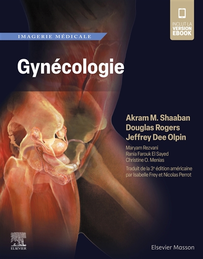 Imagerie médicale : gynécologie