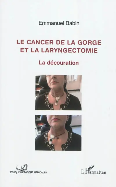 Le cancer de la gorge et la laryngectomie : la découration
