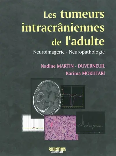 Les tumeurs intracrâniennes de l'adulte à l'exclusion de la base du crâne et de la région hypophysaire : neuroimagerie, neuropathologie