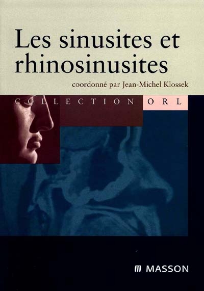 Les sinusites et rhinosinusites