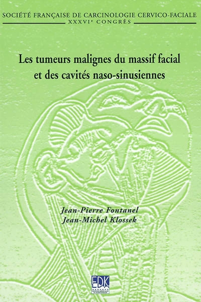 Les tumeurs malignes du massif facial et des cavités naso-sinusiennes