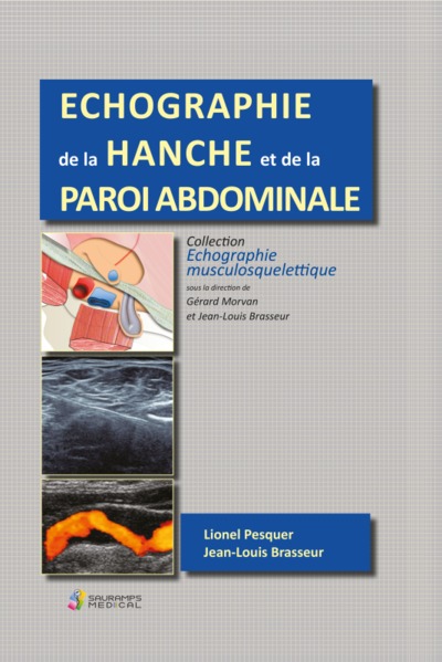 Echographie de la hanche et de la paroi abdominale