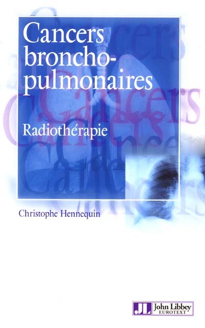 Cancers broncho-pulmonaires. Vol. 2. Cancers broncho-pulmonaires : radiothérapie