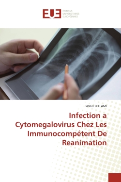 Infection a Cytomegalovirus...