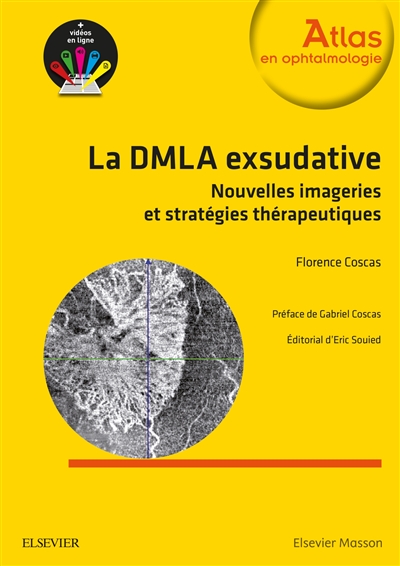 La DMLA exsudative : nouvelles imageries et stratégies thérapeutiques