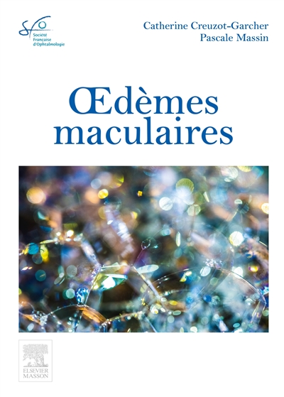 Oedèmes maculaires : rapport SFO 2016