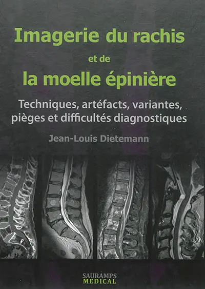 Imagerie du rachis et de la moelle épinière : techniques, artéfacts, variantes, pièges et difficultés diagnostiques