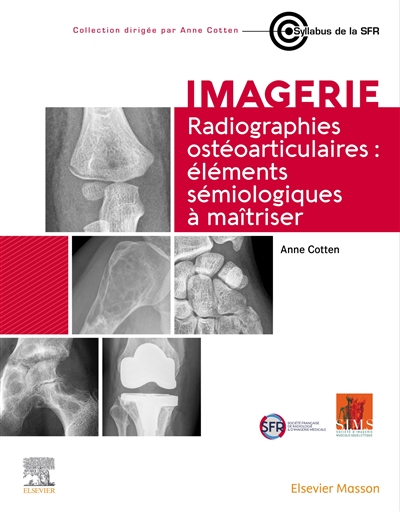 Radiographies ostéoarticulaires : éléments sémiologiques à maîtriser