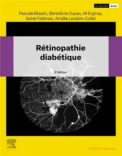 Rétinopathie diabétique