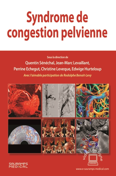 Syndrome de congestion...