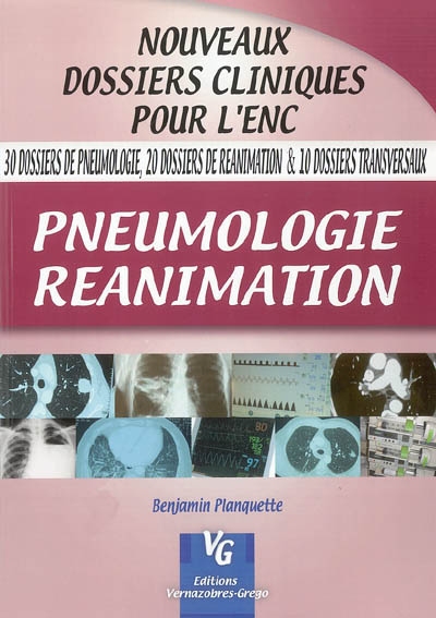 Pneumologie, réanimation : 30 dossiers de pneumologie, 20 dossiers de réanimation & 10 dossiers transversaux