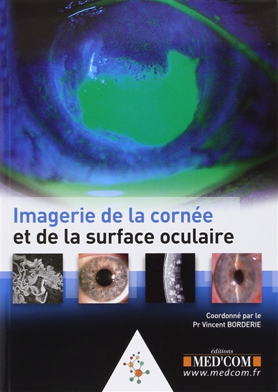 imagerie de la cornée et de la surface oculaire