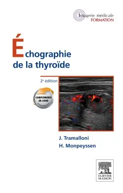 Echographie de la thyroïde