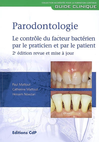 Parodontologie : le contrôle du facteur bactérien par le praticien et par le patient