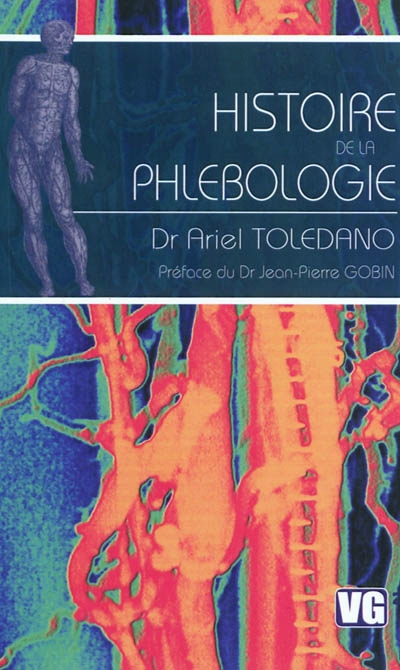 Histoire de la phlébologie