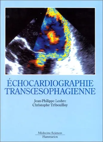 L'échocardiographie transoesophagienne