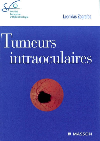 Tumeurs intraoculaires