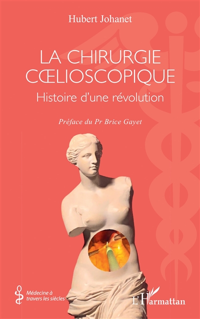 La chirurgie coelioscopique : histoire d'une révolution