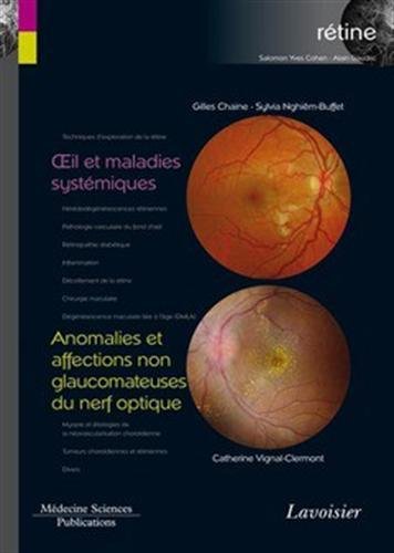 Rétine. Vol. 5. Oeil et maladies systémiques. Anomalies et affections non glaucomateuses du nerf optique
