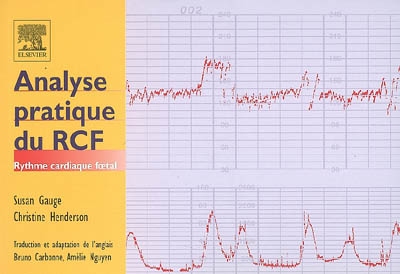 Analyse pratique du RCF, rythme cardiaque foetal