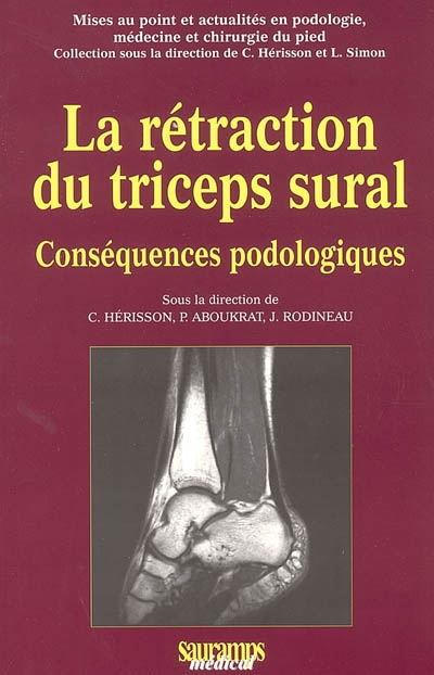 La rétraction du triceps sural : conséquences podologiques