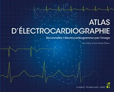 Atlas d'électrocardiographie : reconnaître l'électrocardiogramme par l'image