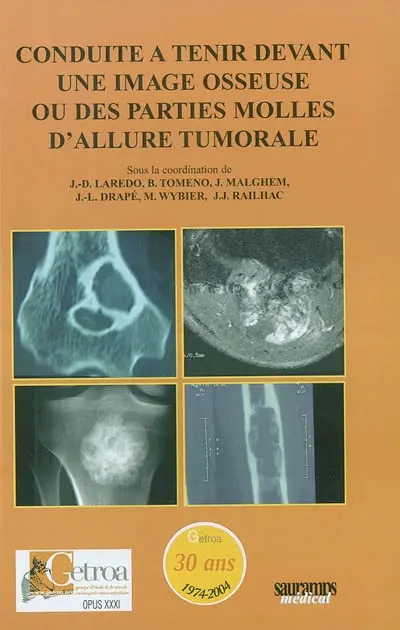 Conduite à tenir devant une image osseuse ou des parties molles d'allure tumorale