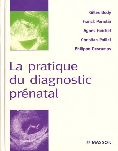 La pratique du diagnostic prénatal
