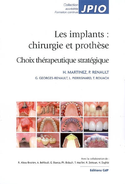 Les implants : chirurgie et prothèse : choix thérapeutique stratégique