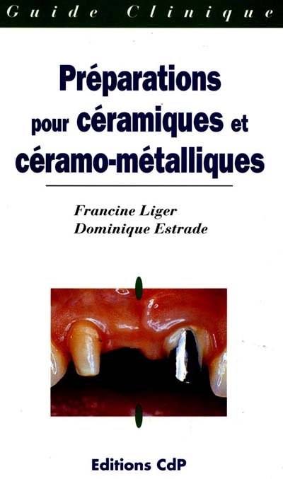 Préparation pour céramiques...
