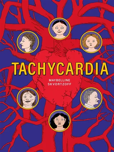 Tachycardia