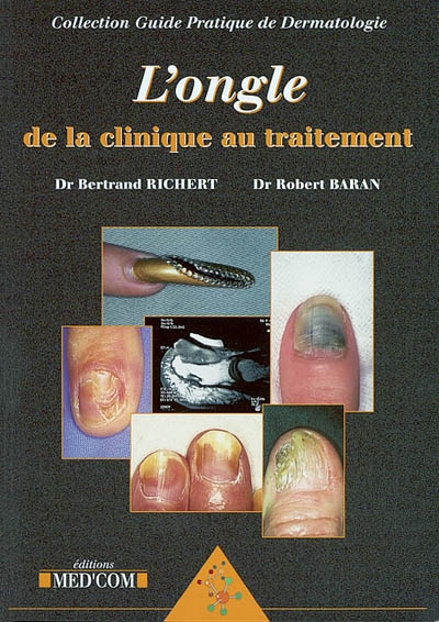 L'ongle : de la clinique au traitement